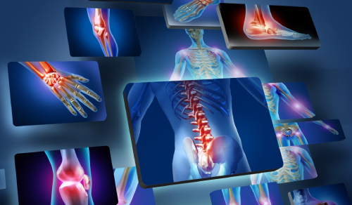 chấn thương thể thao